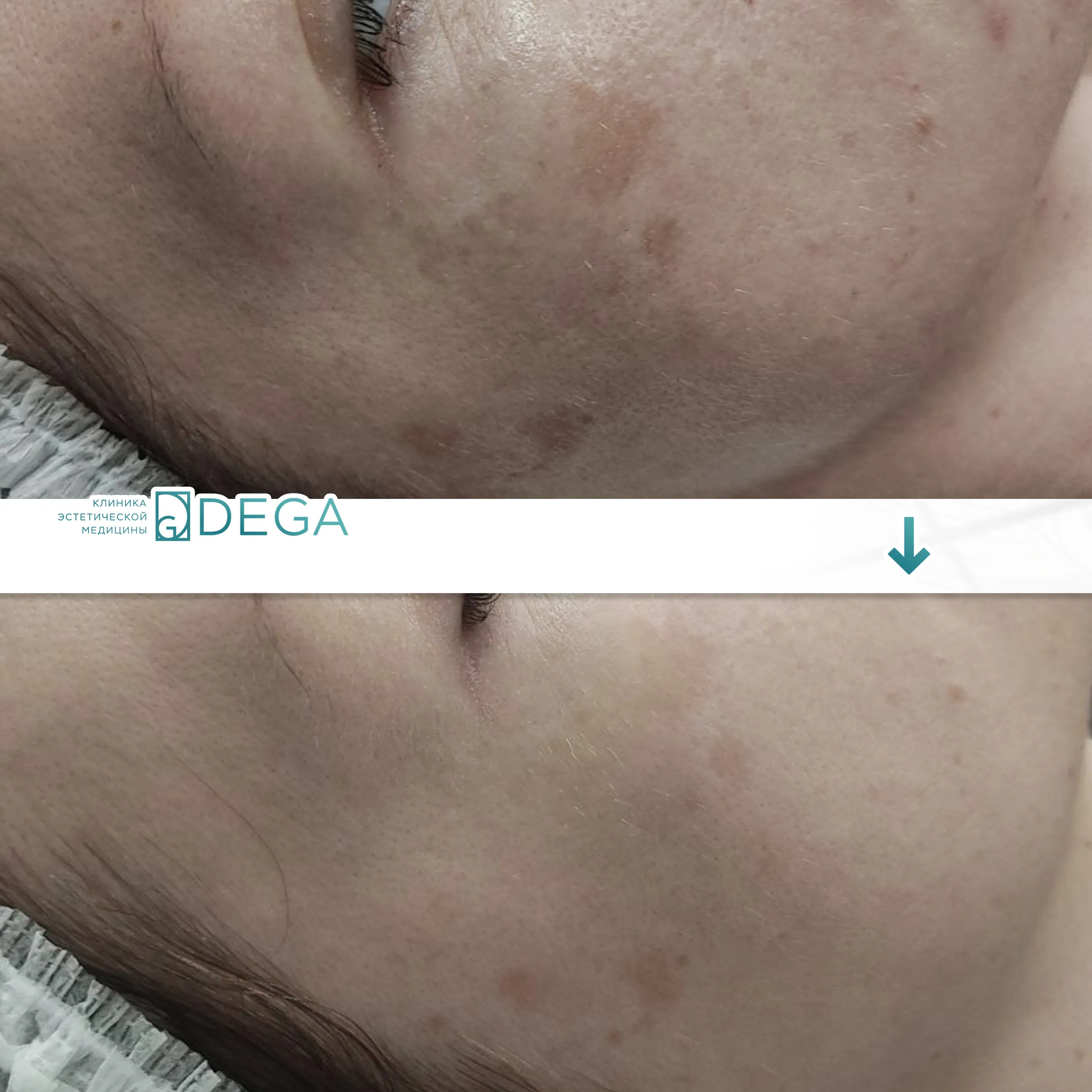 Бабичева С.Ю. — Фотодинамическая терапия №6