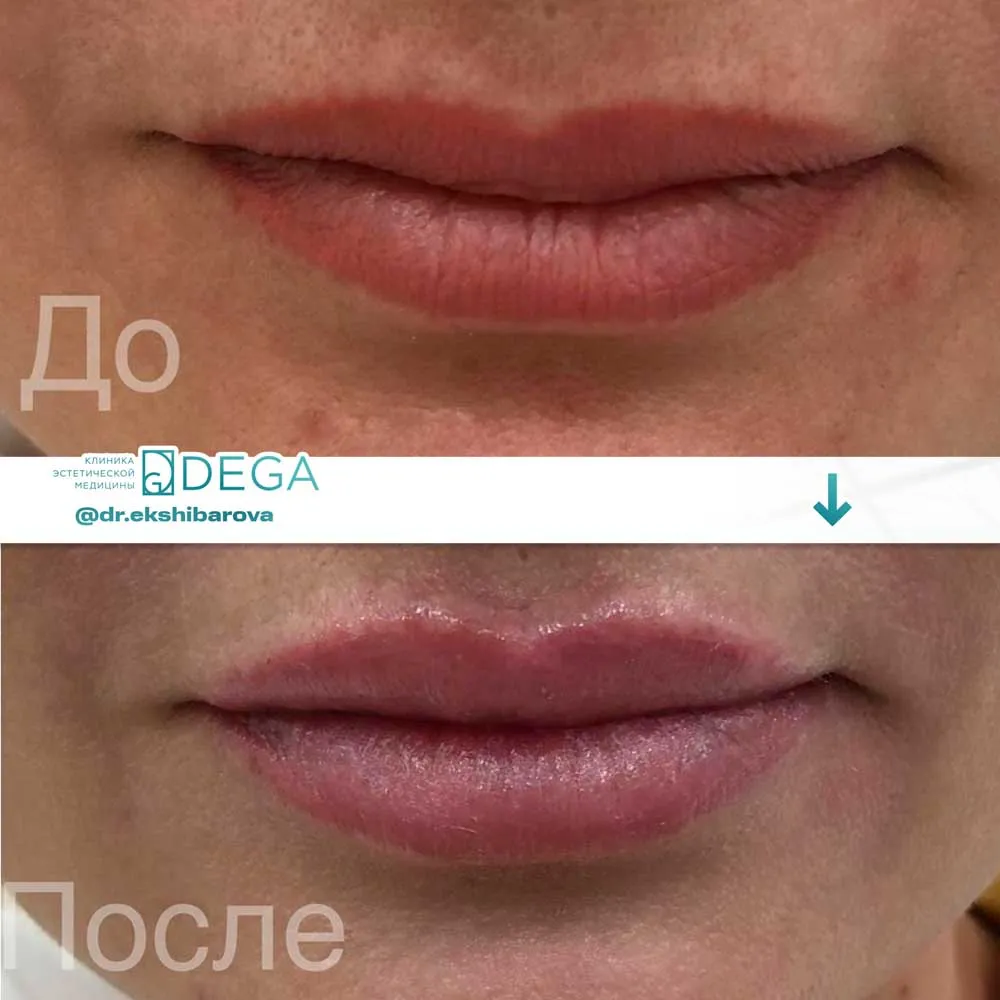 Екшибарова НИ - Контурная пластика №10