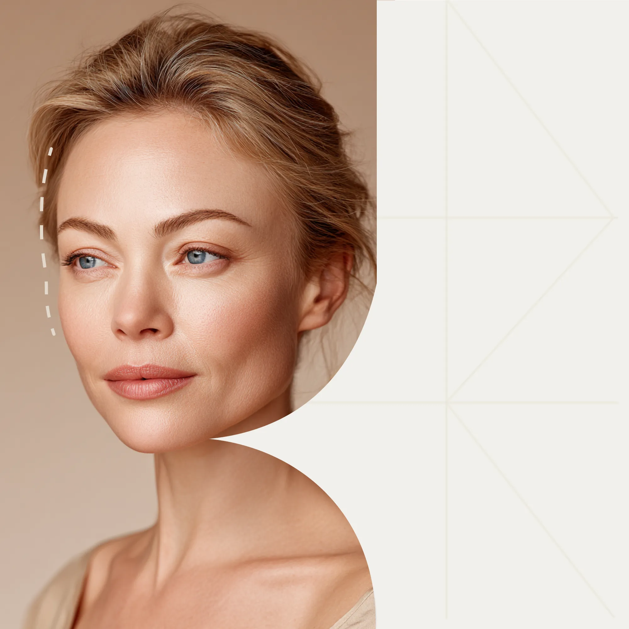 Реабилитация после эндоскопической подтяжки лица