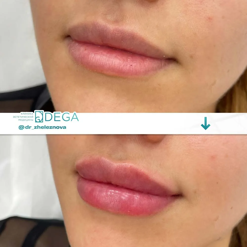 Железнова Яна Алексеевна - КП № 8