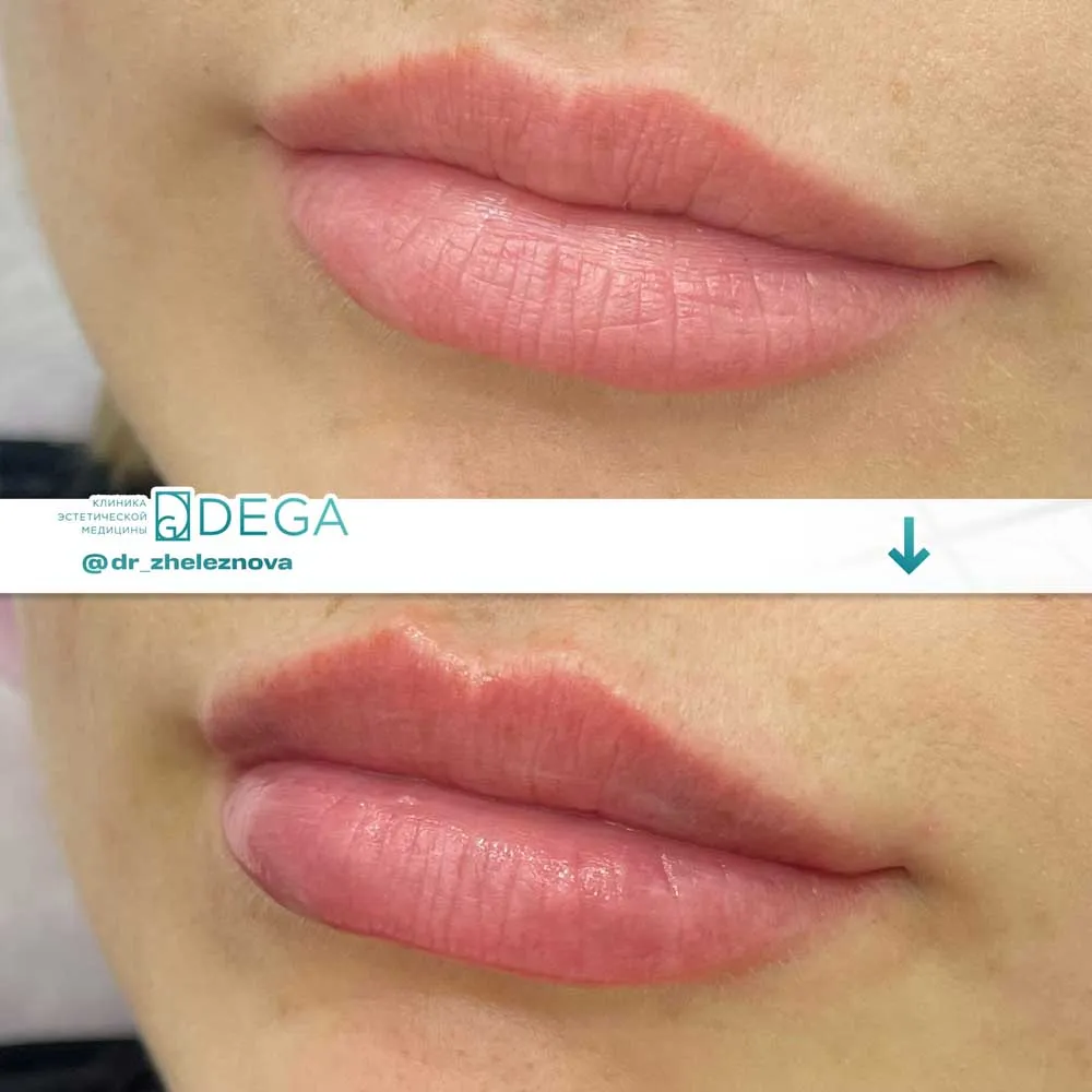 Железнова Яна Алексеевна - КП № 15