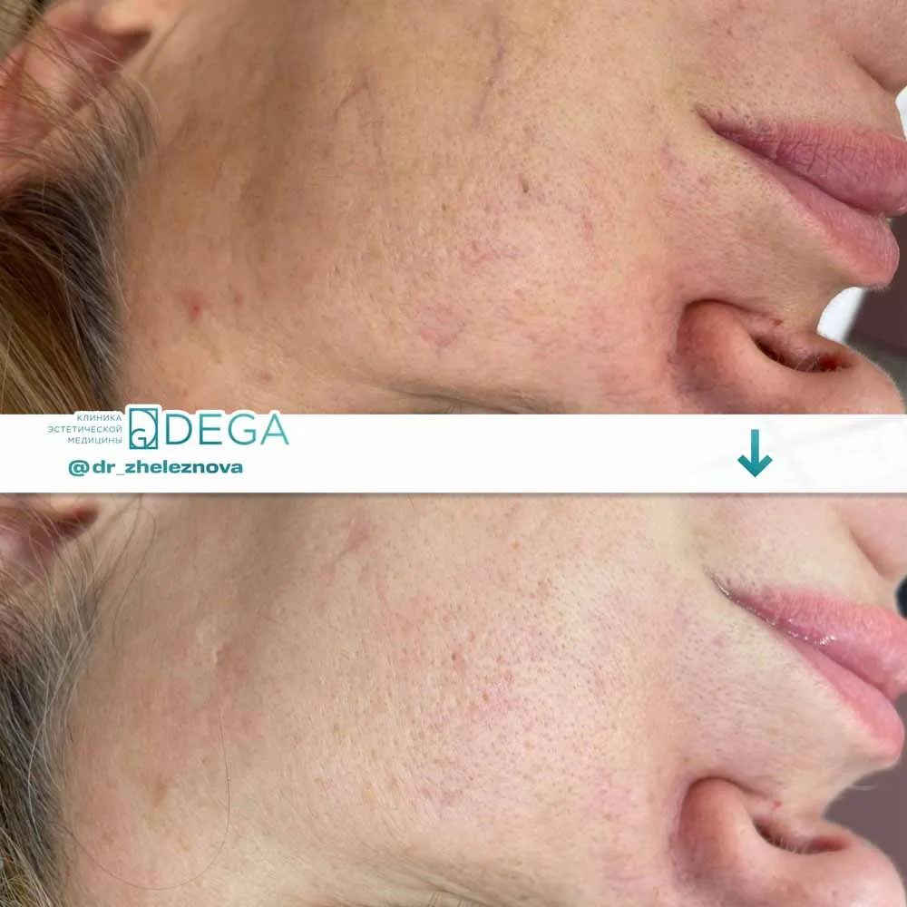 Железнова Яна Алексеевна - Фото № 18