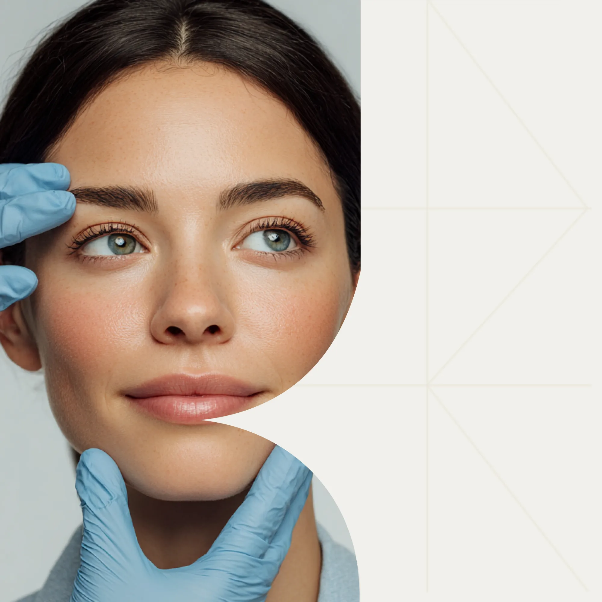 Осложнения после трансконъюктивальной блефаропластики