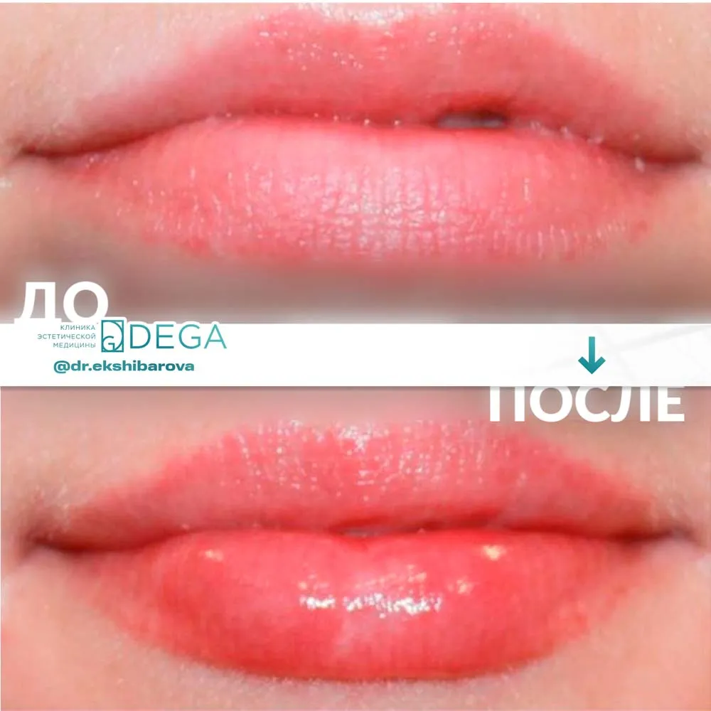 Екшибарова НИ - Контурная пластика №9