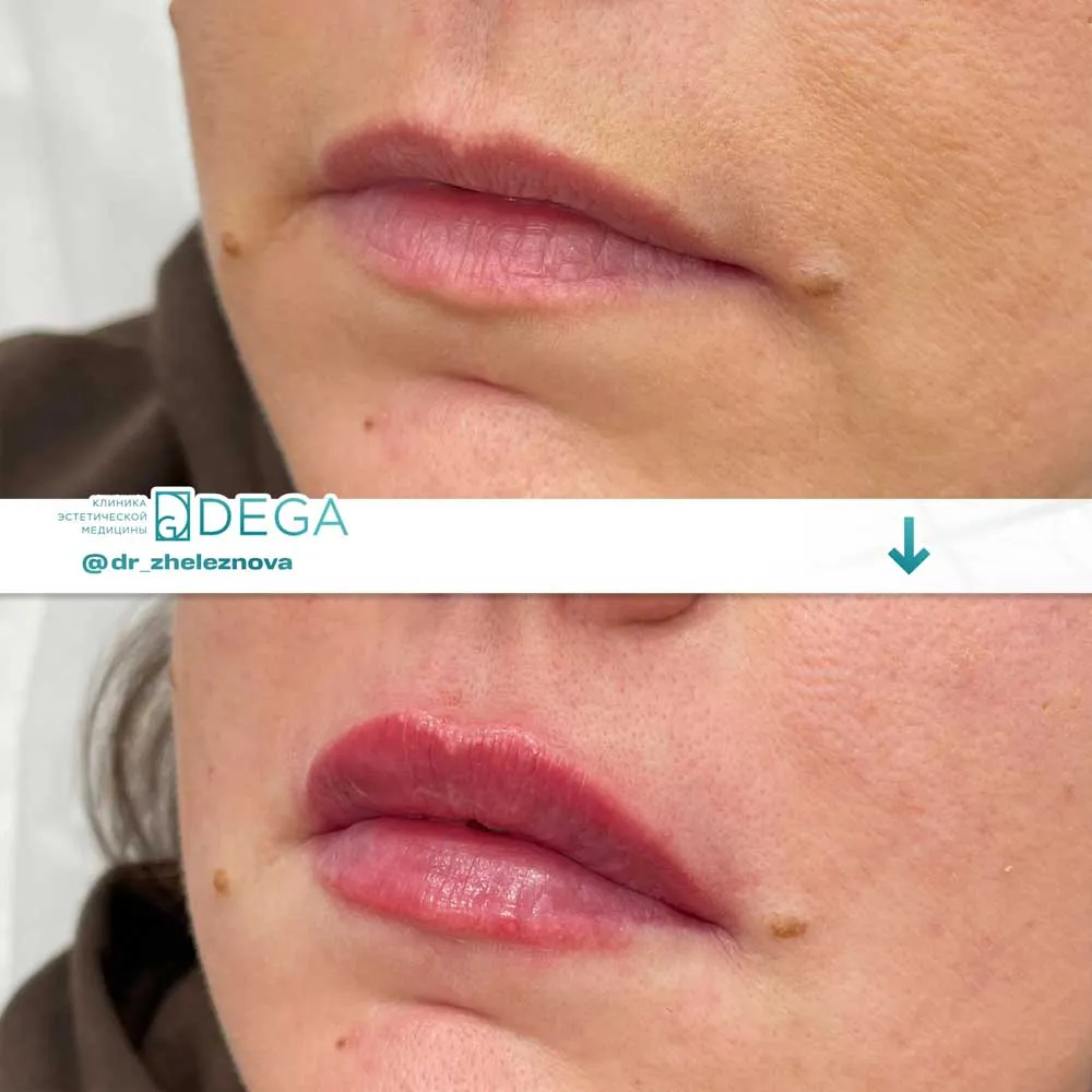 Железнова Яна Алексеевна - КП № 16