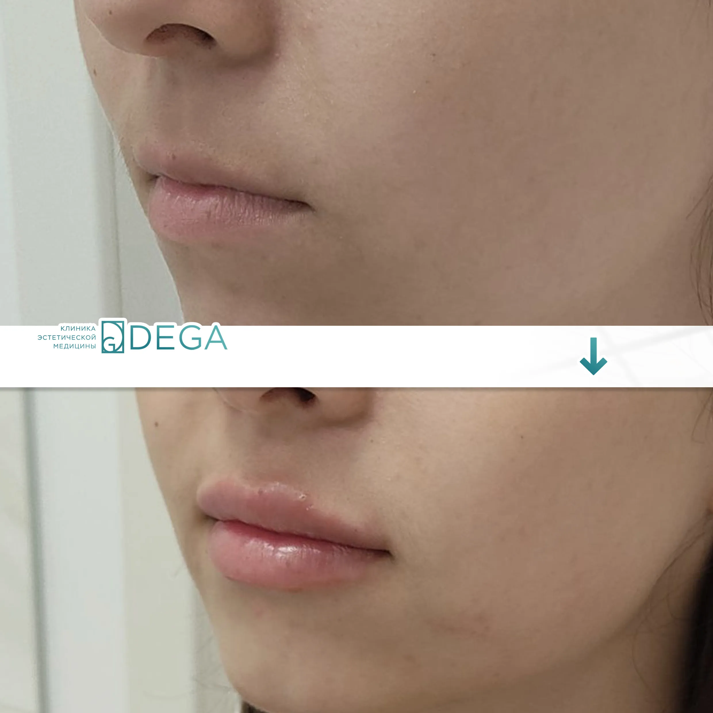 Бабичева С.Ю. — Контурная пластика №2