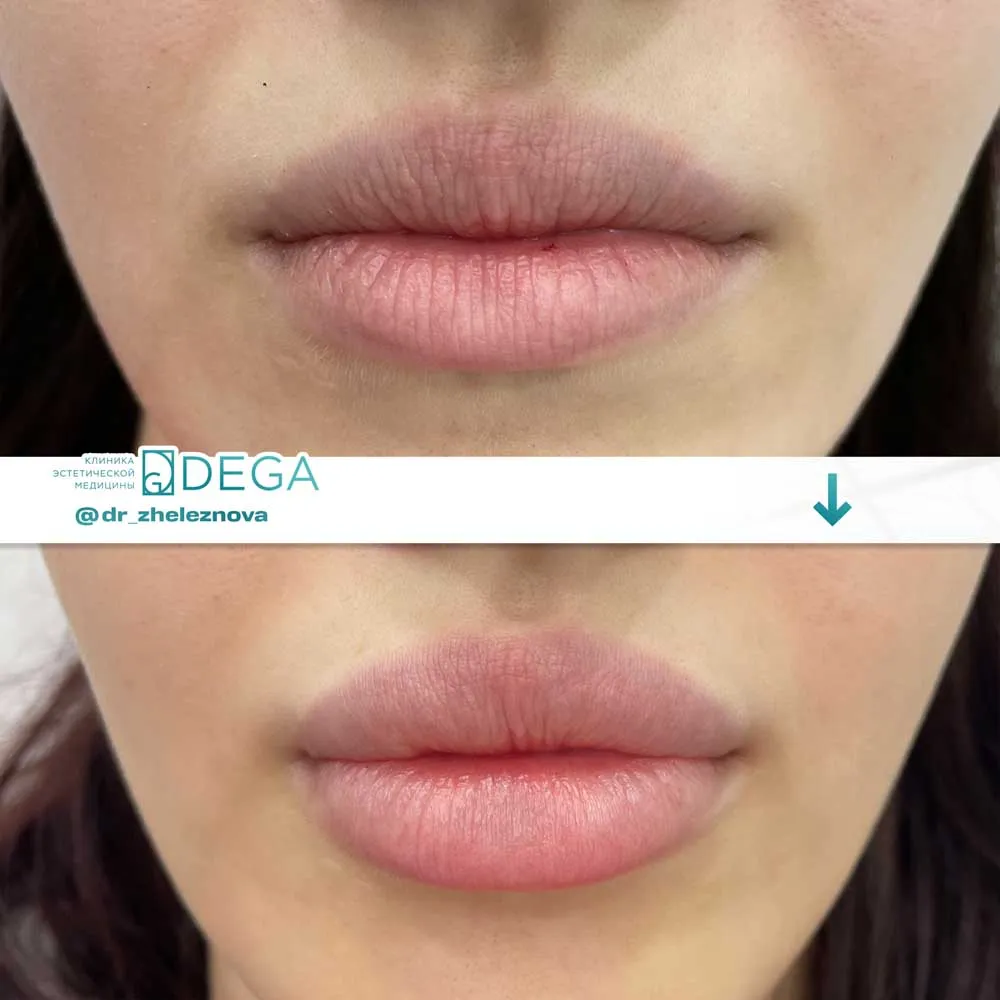 Железнова Яна Алексеевна - КП № 11