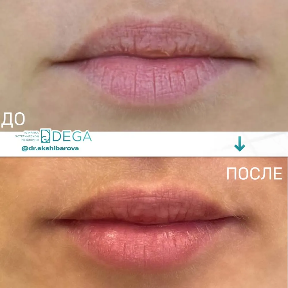 Екшибарова НИ - Контурная пластика №7