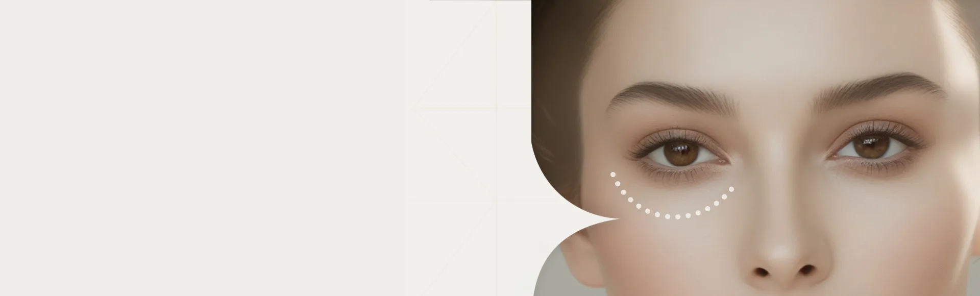 Ограничения после блефаропластики