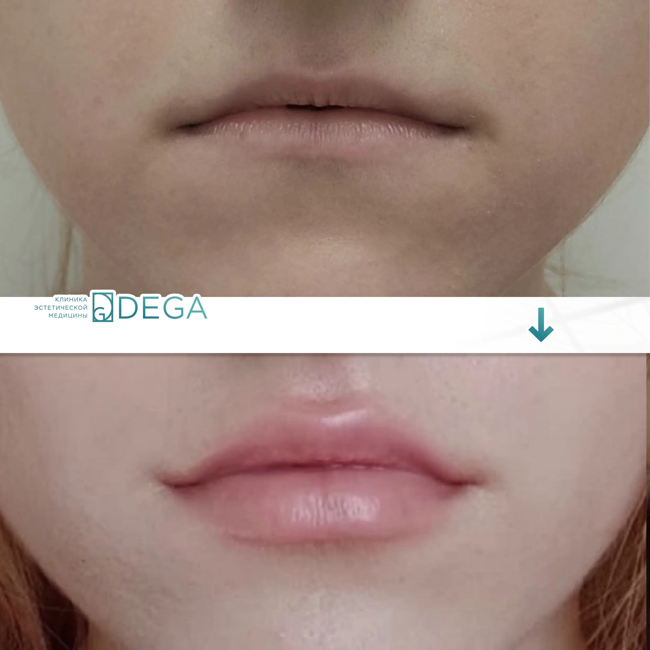 Бабичева С.Ю. — Контурная пластика №5