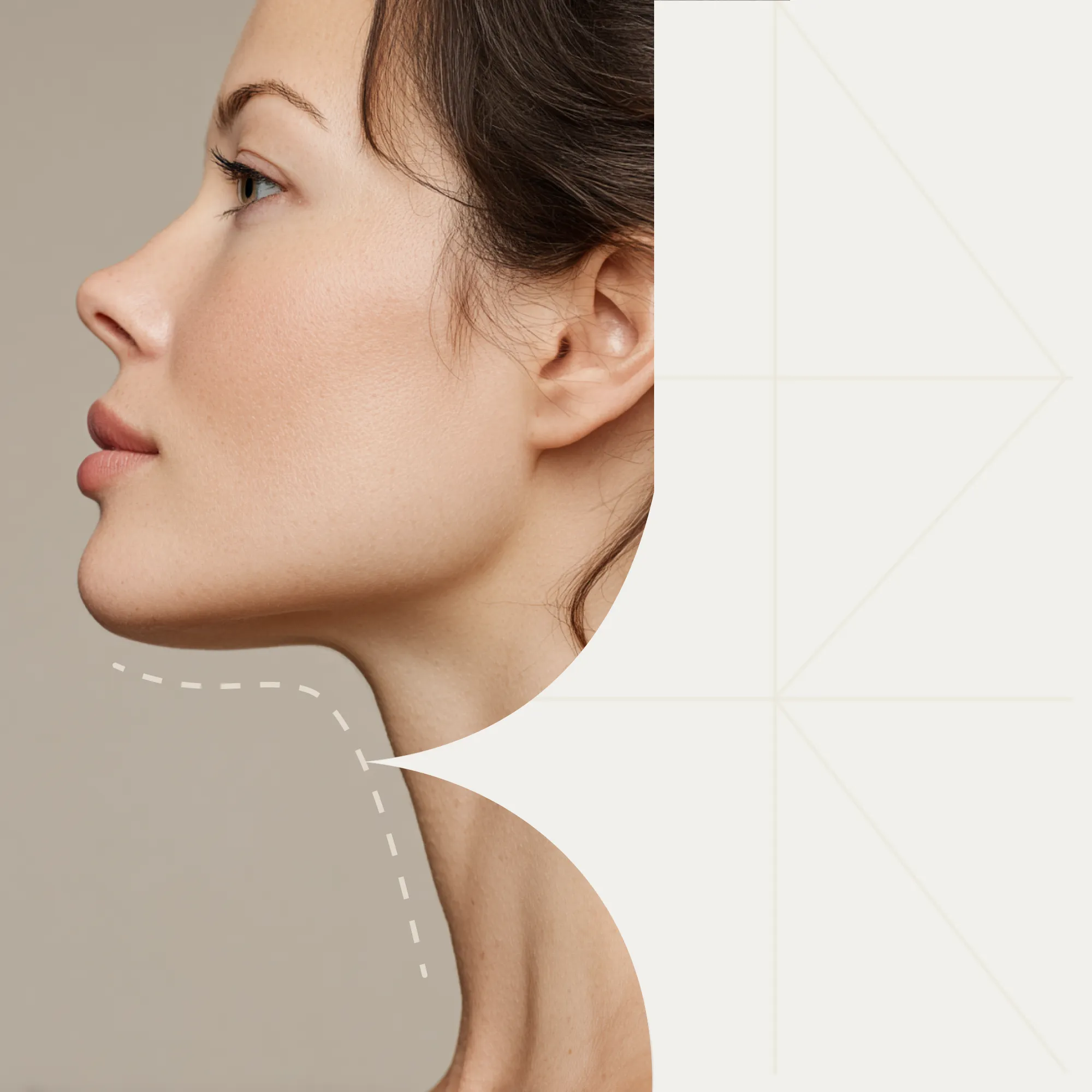 Реабилитация после подтяжки нижней трети лица