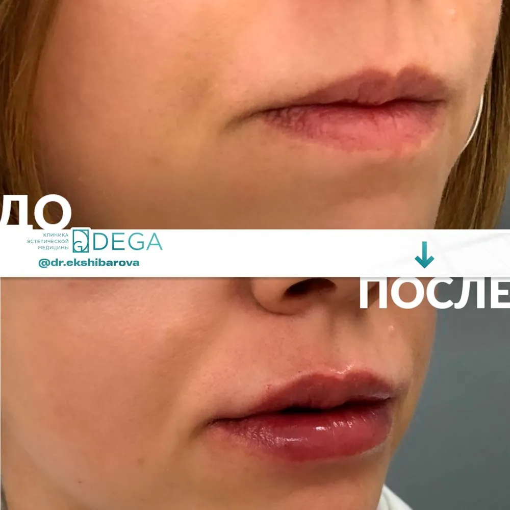 Екшибарова НИ - Контурная пластика №8