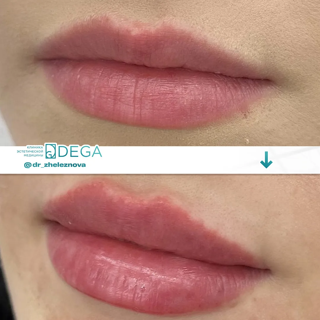 Железнова Яна Алексеевна - Контурная пластика № 24