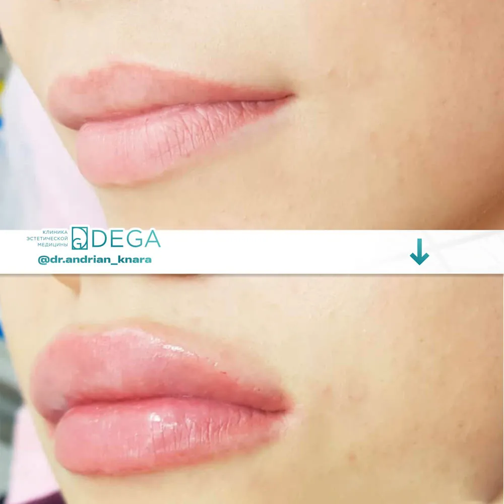 Андрян КВ - Контурная пластика №15