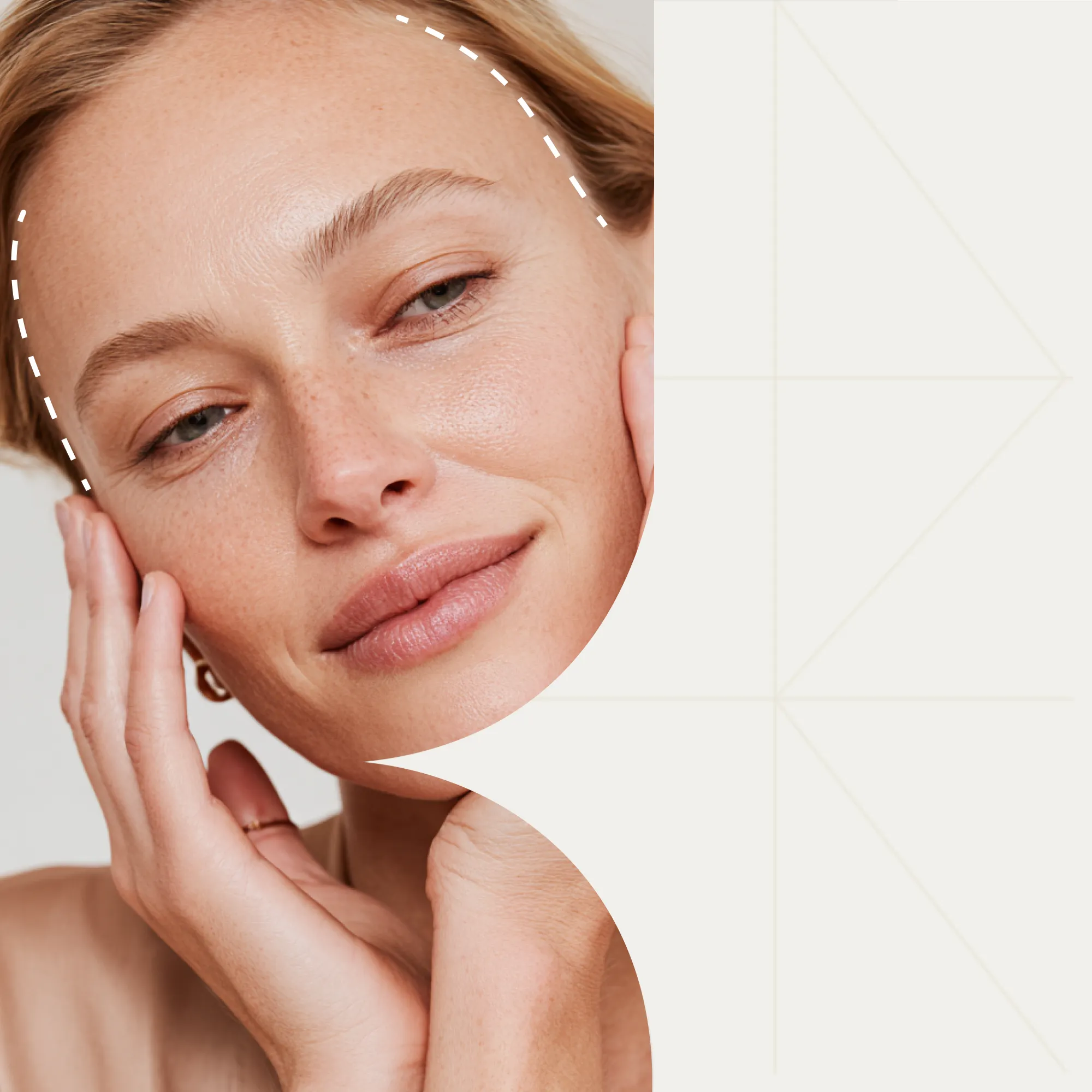 Восстановление после подтяжки верхней трети лица