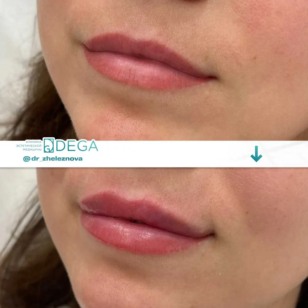 Железнова Яна Алексеевна - КП № 13