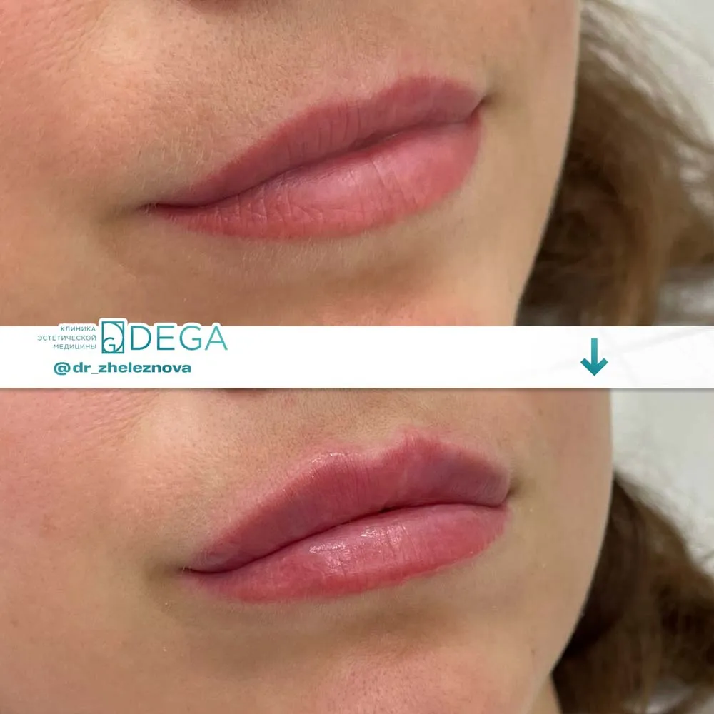 Железнова Яна Алексеевна - КП № 14