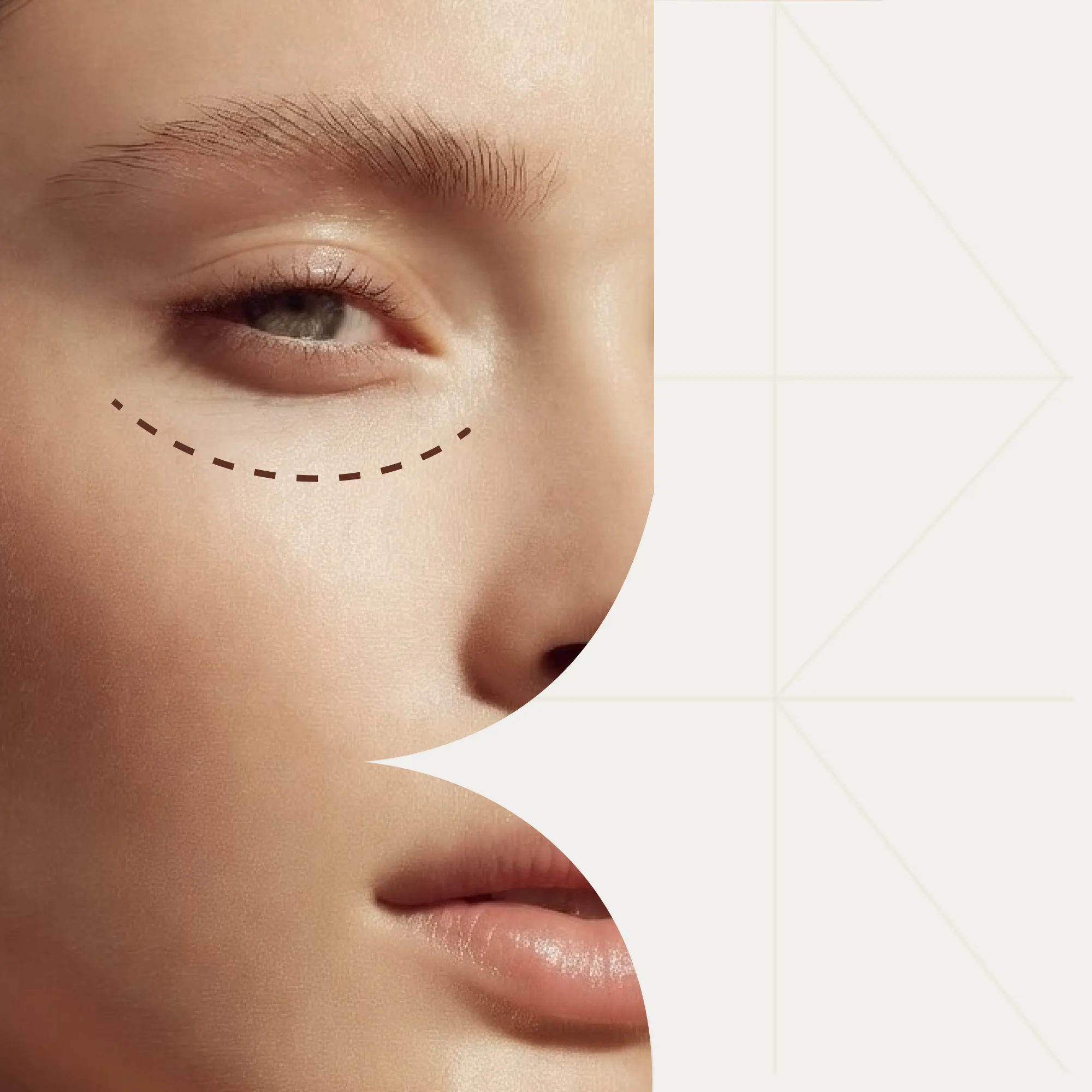 Периорбитопластика и блефаропластика: отличия