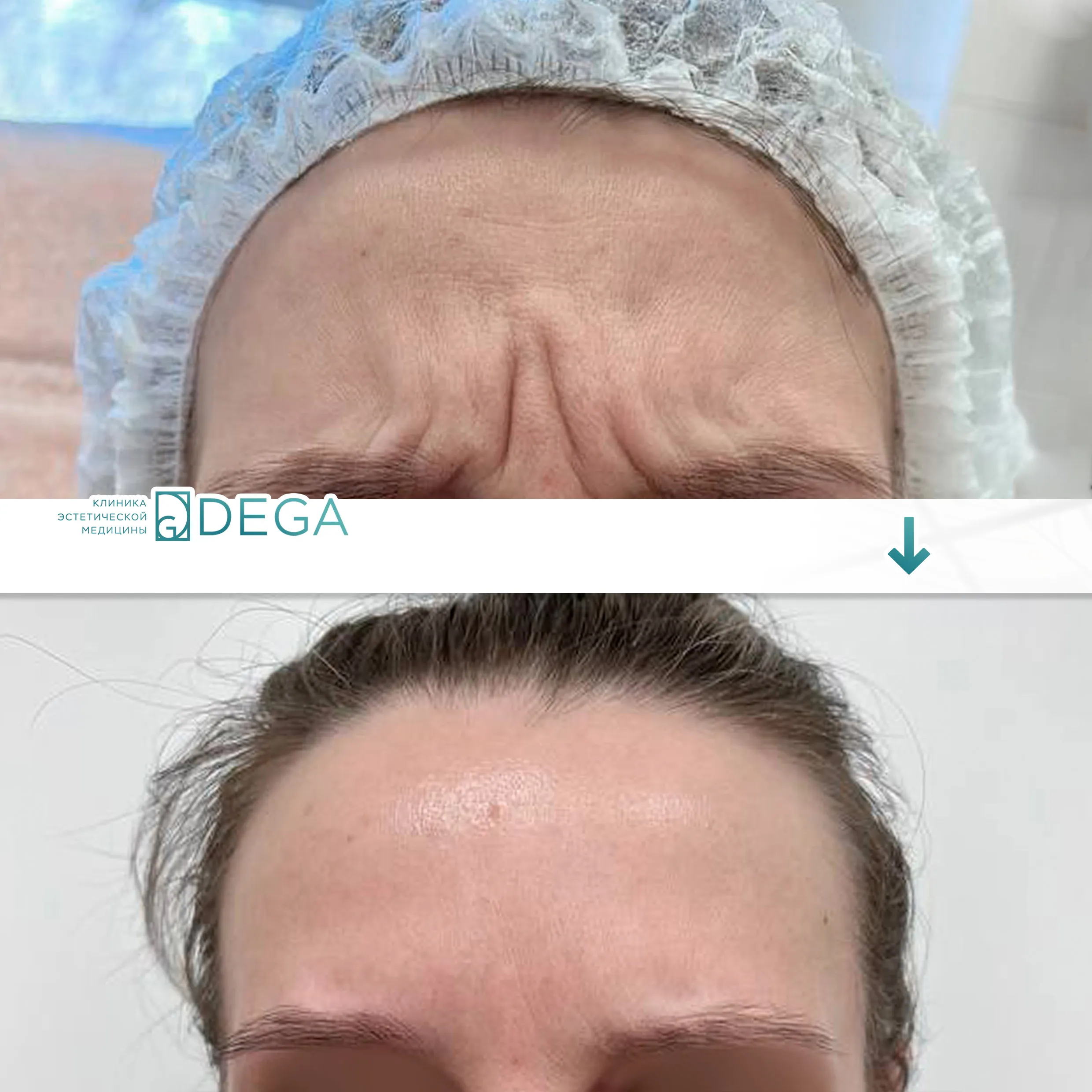 Сергиенко ЮВ- Ботулинотерапия №2