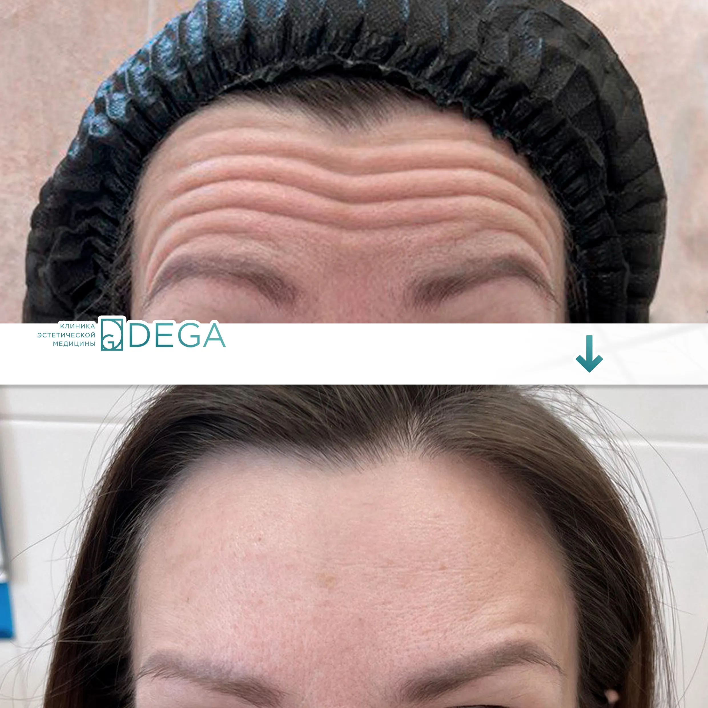 Сергиенко ЮВ- Ботулинотерапия №1