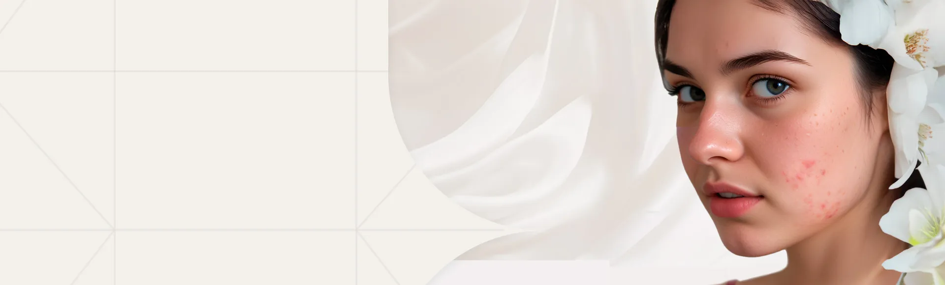 Топ способов коррекции постакне