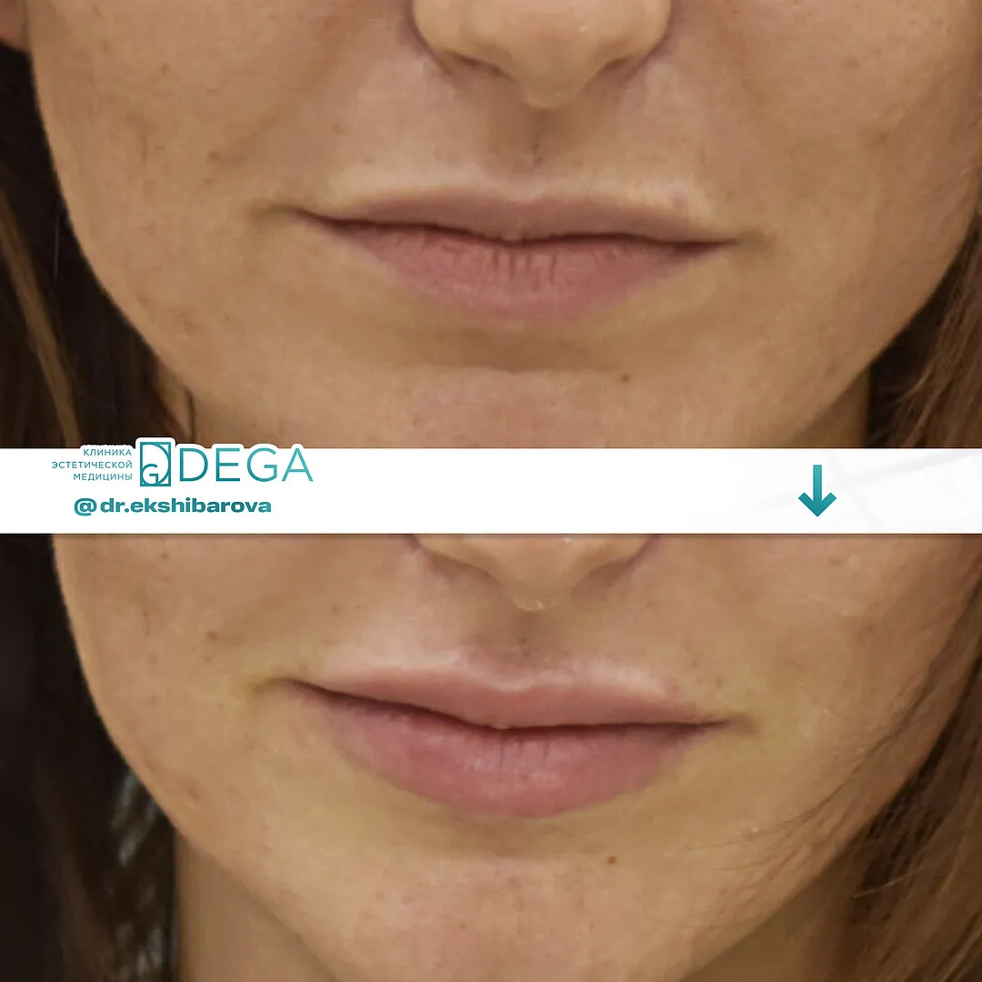 Екшибарова НИ - Контурная плстика №81